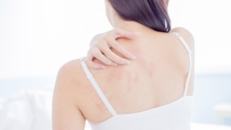Psoriasis : prévention et traitements